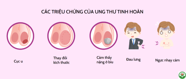 Các dấu hiệu, triệu chứng của ung thư tinh hoàn