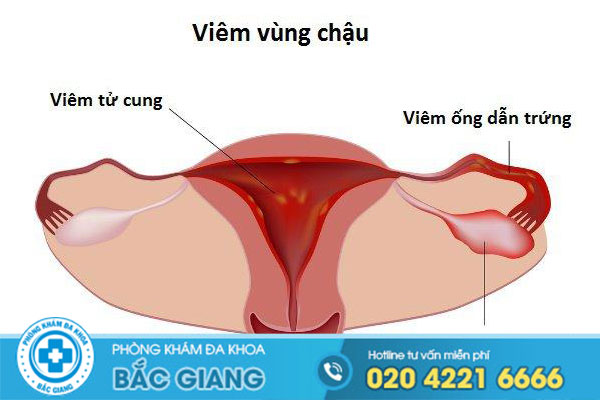 benh-viem-vung-chau-nguyen-nhan-bien-chung-va-cach-dieu-tri