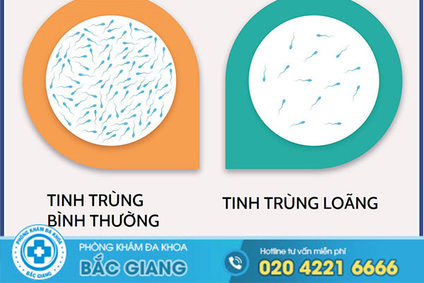 tinh-trung-loang-so-luong-tinh-trung-thap-co-anh-huong-den-kha-nang-sinh-san