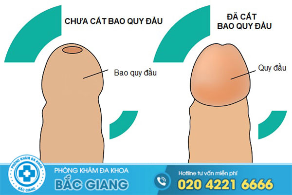 dia-chi-cat-bao-quy-dau-o-thanh-pho-bac-giang